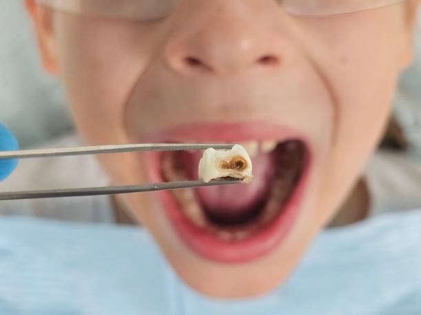 Best Emergency Treatment for Toothache in Woodcliff Lake, NJ